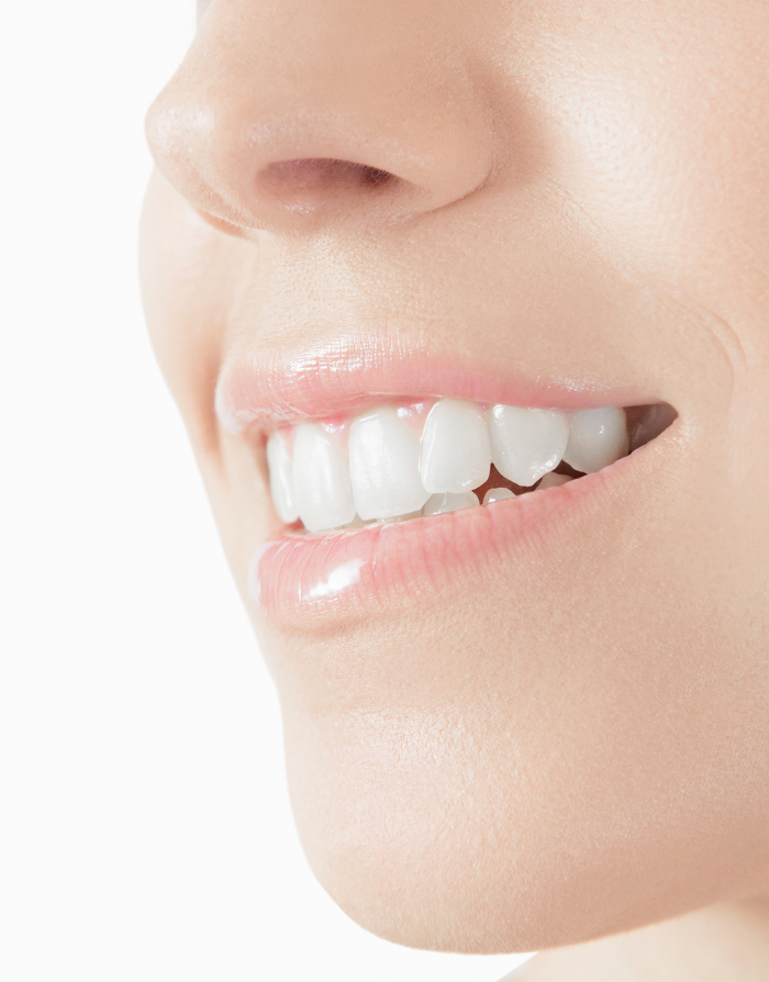 ワンデー治療（セレック）のイメージ